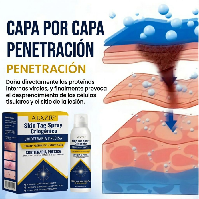 🏆 Crioterapia Profesional en Casa | AEXZR® Skin Tag Spray Criogénico：Eliminación rápida y sin dolor de verrugas y córneas ✨