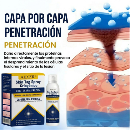 🏆 Crioterapia Profesional en Casa | AEXZR® Skin Tag Spray Criogénico：Eliminación rápida y sin dolor de verrugas y córneas ✨