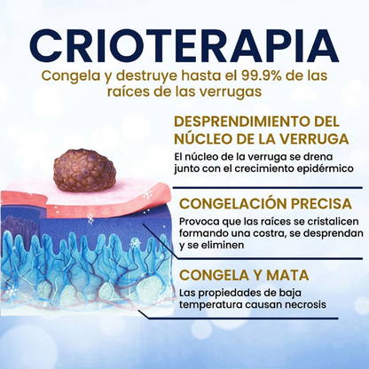 🏆 Crioterapia Profesional en Casa | AEXZR® Skin Tag Spray Criogénico：Eliminación rápida y sin dolor de verrugas y córneas ✨