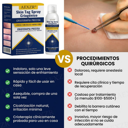 🏆 Crioterapia Profesional en Casa | AEXZR® Skin Tag Spray Criogénico：Eliminación rápida y sin dolor de verrugas y córneas ✨