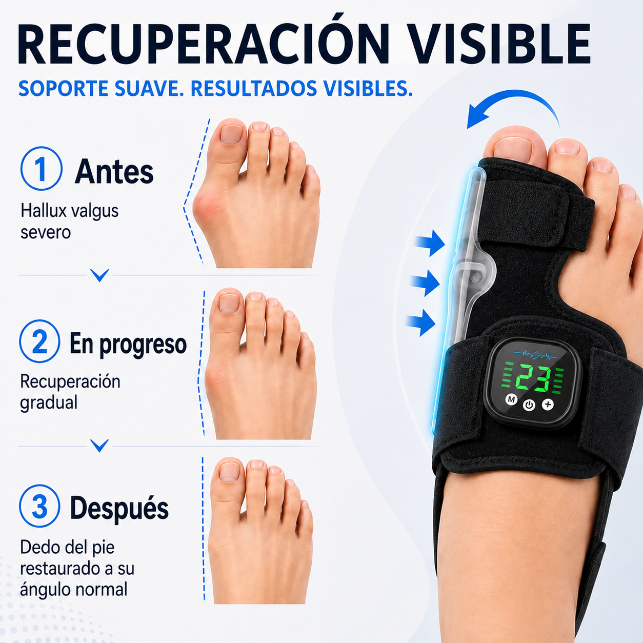 AEXZR® Nexalign Pro — Corrector de juanete EMS