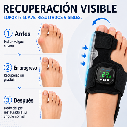 AEXZR® Nexalign Pro — Corrector de juanete EMS