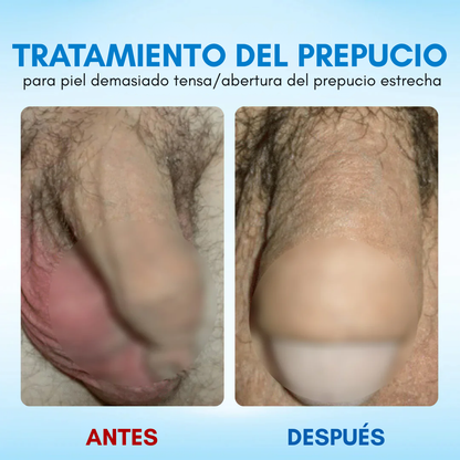 ⚡ RZXEA™ Gel de Elasticidad para el Prepucio: Recupera tu máximo nivel, reinicia tu vitalidad.