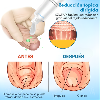 ⚡ RZXEA™ Gel de Elasticidad para el Prepucio: Recupera tu máximo nivel, reinicia tu vitalidad.
